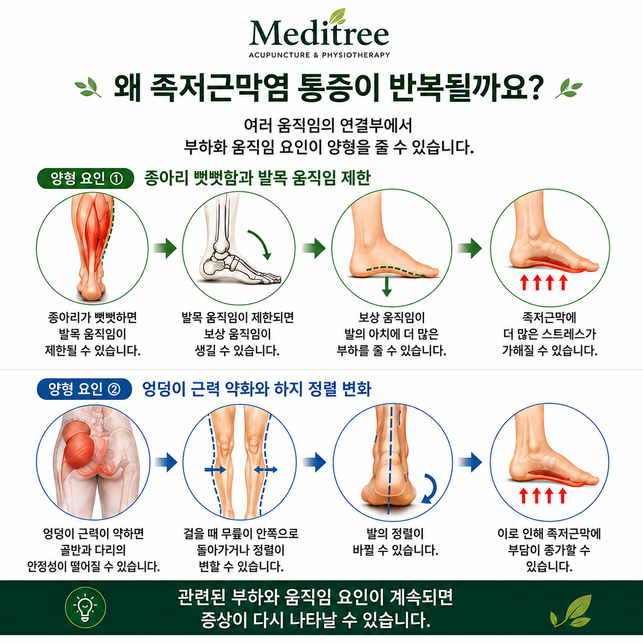 종아리와 발목 움직임, 엉덩이 근력과 하지 조절이 족저근막 부하에 영향을 줄 수 있음을 설명하는 이미지